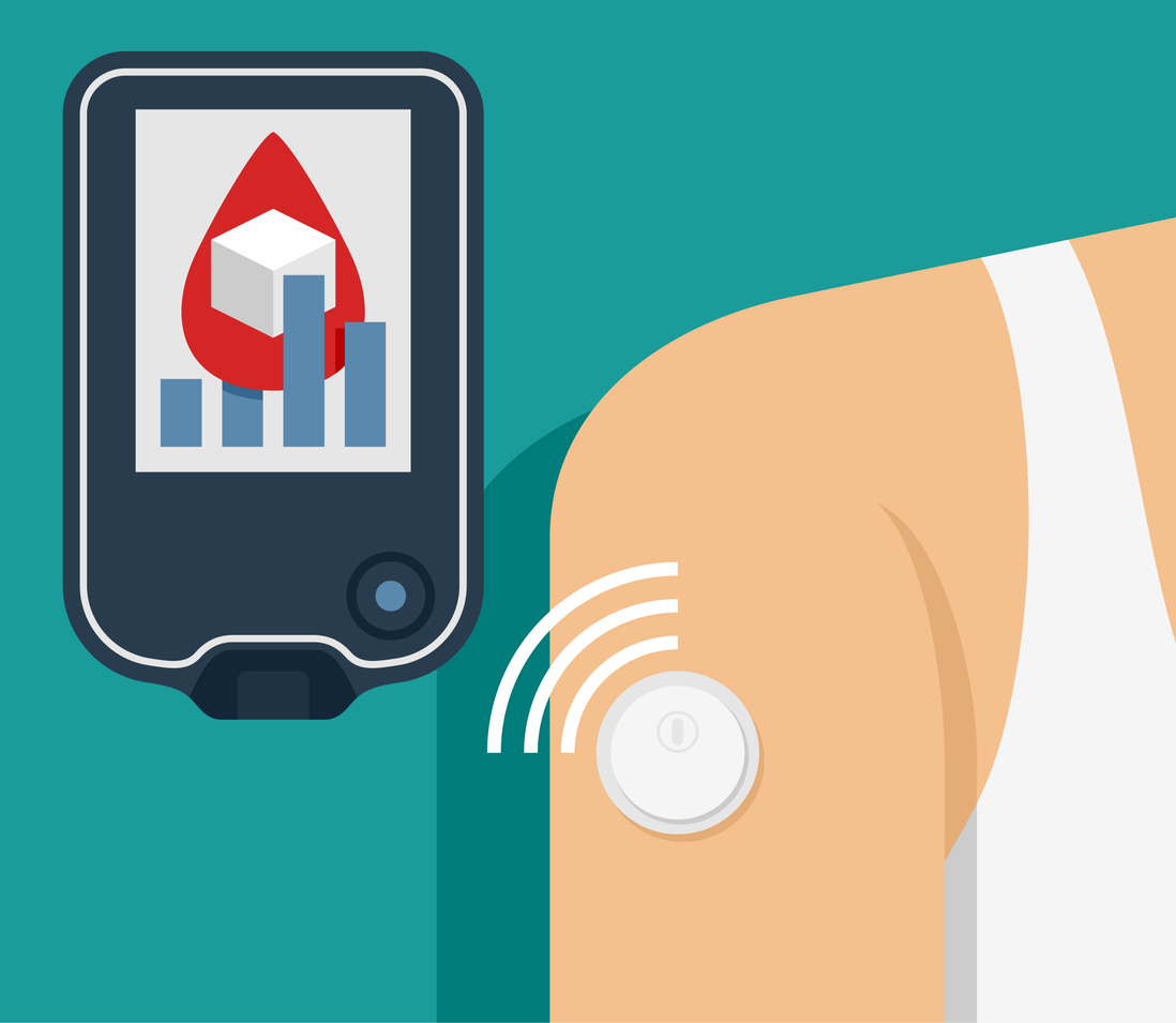 Мониторинг глюкозы: революция в понимании собственного метаболизма